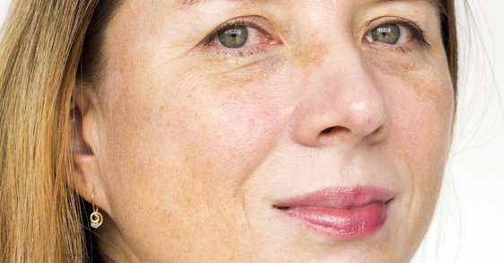 öregedésgátló megoldás bőrgyógyászat által bőrápolás