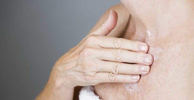 Magasabb a bőrrák kockázata menopauza alatt?