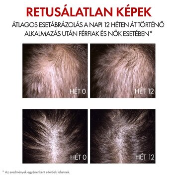 Aminexil Clinical R.E.G.E.N. BOOSTER hajregeneráló szérum