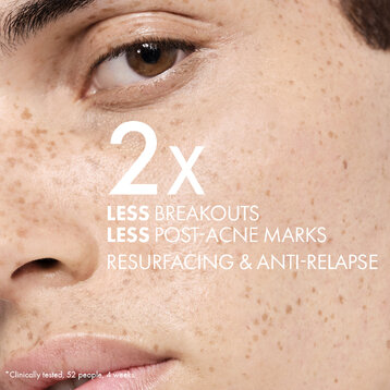 SZÉRUM EGY TISZTÍTÓBAN, MINDENNAPOS HÁMLASZTÓ